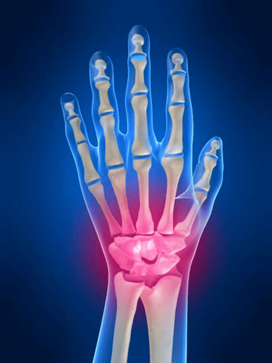 Handwriting arthritis