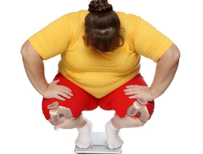 Among patients suffering from arthrosis, most are overweight or obese